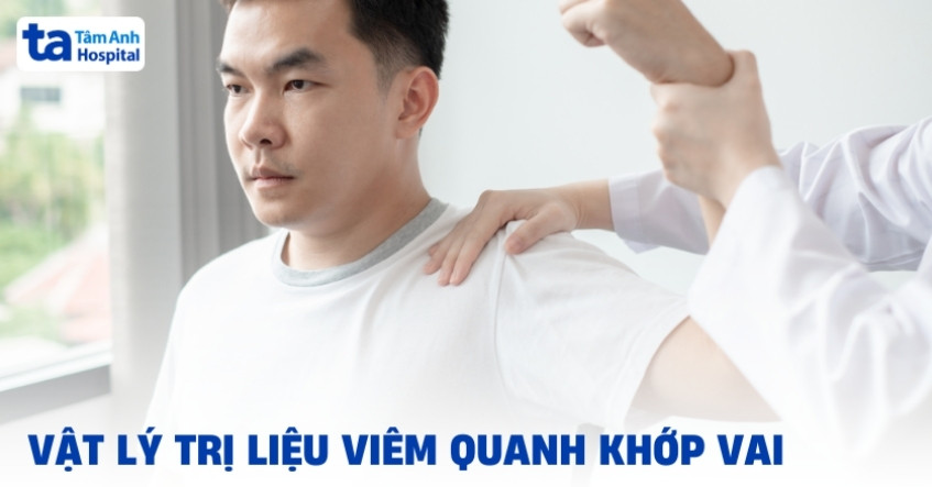 6 bài tập vật lý trị liệu viêm quanh khớp vai hiệu quả cao