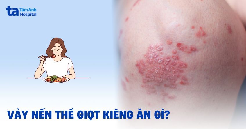 vảy nến thể giọt nên ăn gì