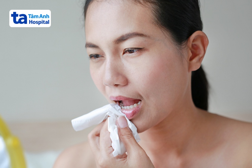vệ sinh vết giời leo ở miệng