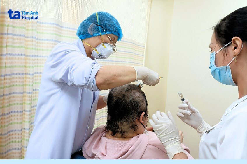 vì sao nên tìm hiểu chi phí và số lần trước khi lăn kim