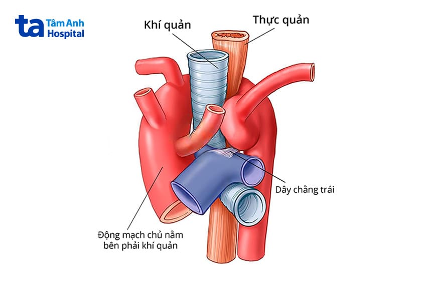 vị trí động mạch chủ nằm bên phải khí quản