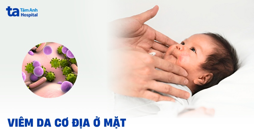 Viêm da cơ địa ở mặt: Nguyên nhân, hình ảnh, cách trị hiệu quả