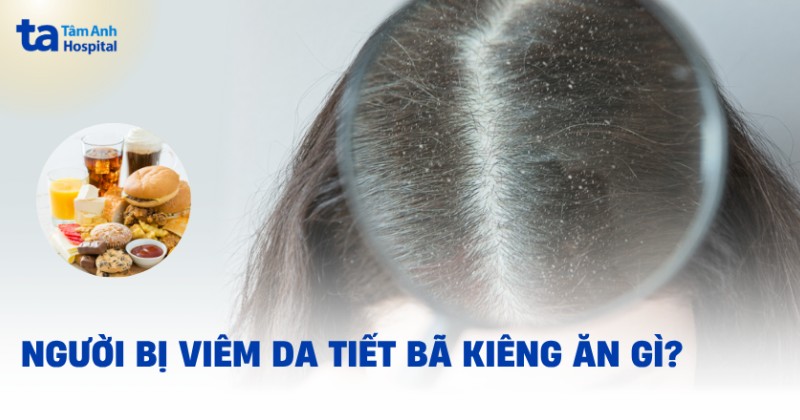 Viêm da tiết bã không nên ăn gì? Thực phẩm cần kiêng và hạn chế dùng