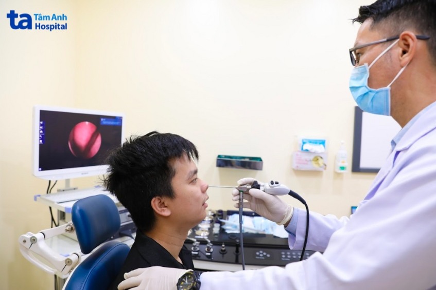 viêm đa xoang có chữa được không