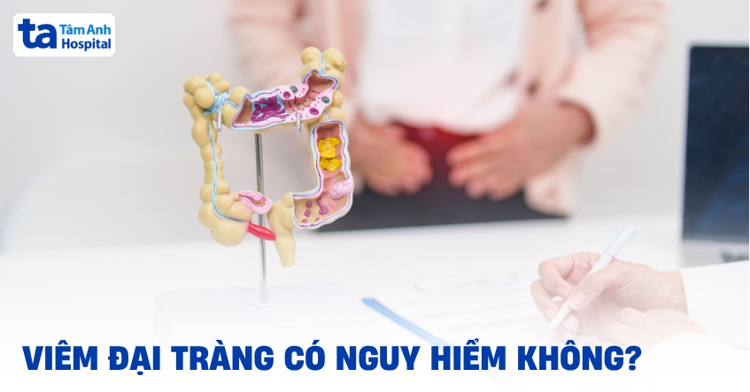 Viêm đại tràng có nguy hiểm không? 7 biến chứng có thể gặp