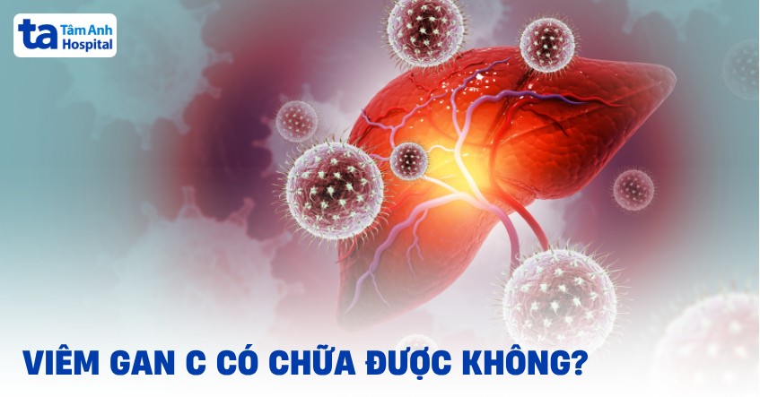 Viêm gan C có chữa được không? Có tự khỏi không?