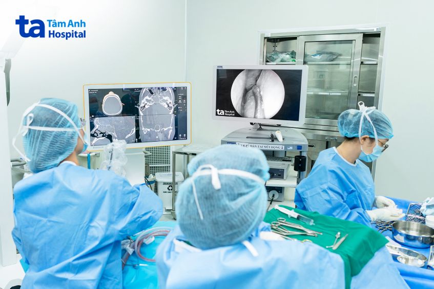 viêm xoang biến chứng hốc mắt