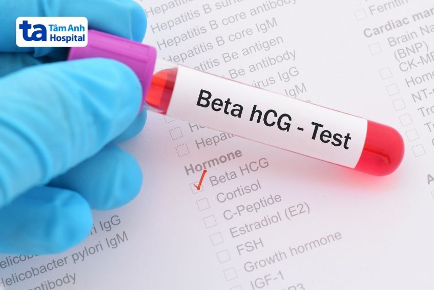 xét nghiệm hcg
