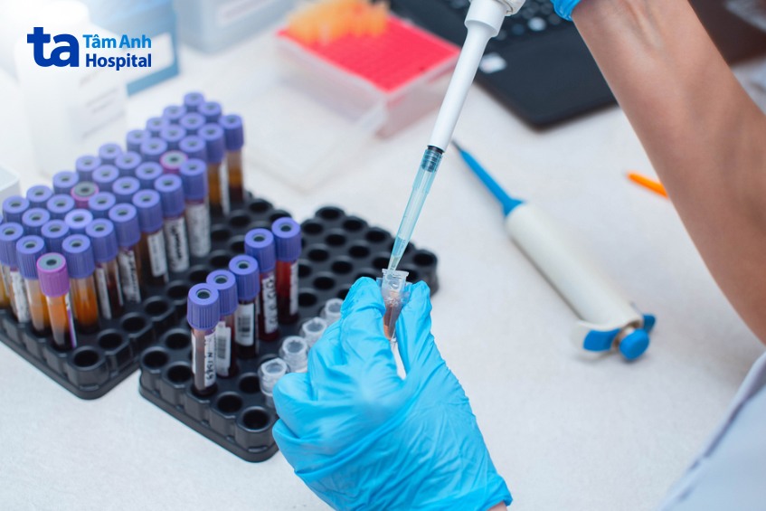 xét nghiệm máu có biết ung thư không