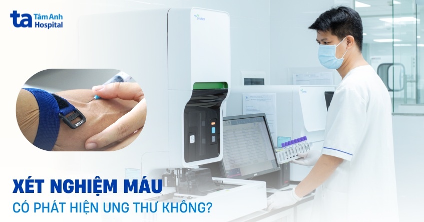 Xét nghiệm máu có phát hiện ung thư không? Độ chính xác đến đâu?