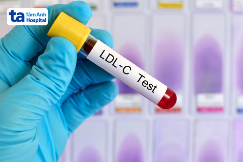 Xét nghiệm máu là phương pháp giúp chẩn đoán tình trạng LDL cholesterol cao