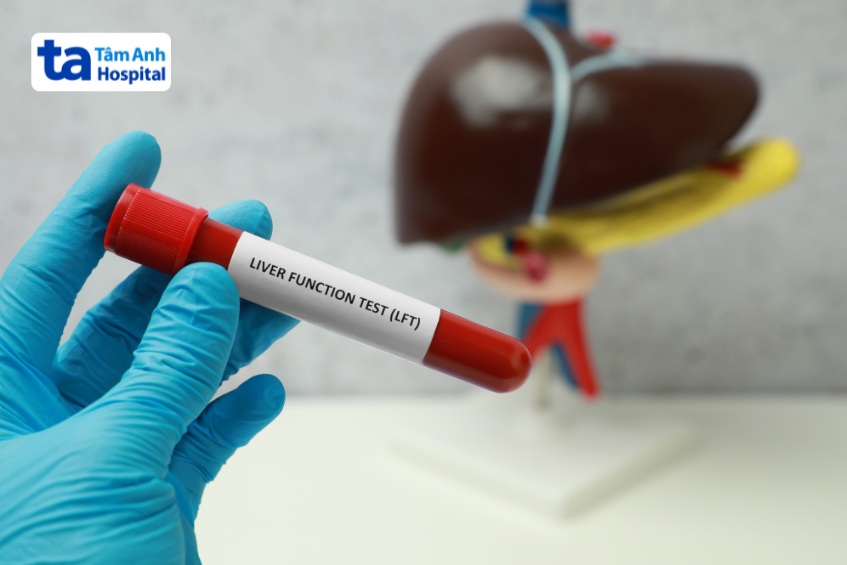 xét nghiệm viêm gan b cấp