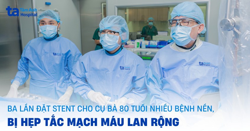 Ba lần đặt stent cho cụ bà hẹp tắc mạch máu lan rộng