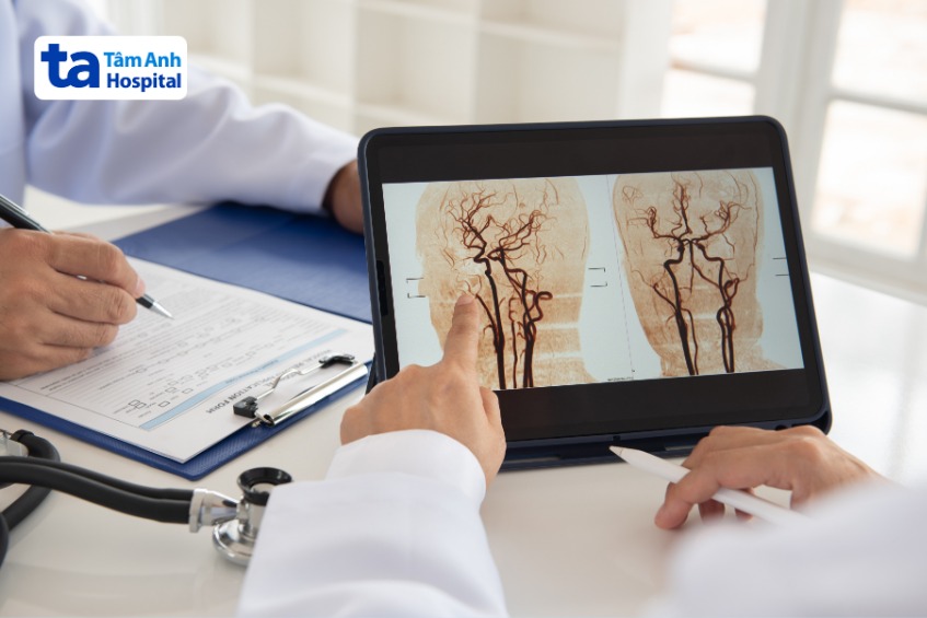 bác sĩ chỉ định điều trị liệt dây thần kinh số 9