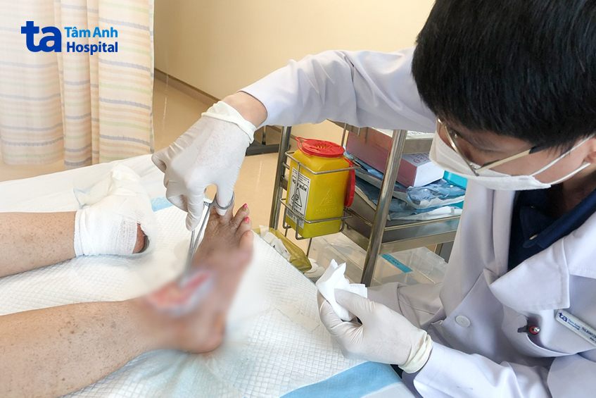 Bác sĩ Văn đang chăm sóc vết thương, thay băng cho bà T