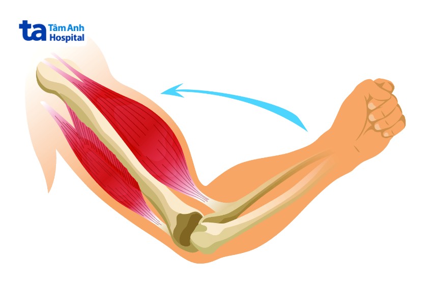 bài tập gập khuỷu tay