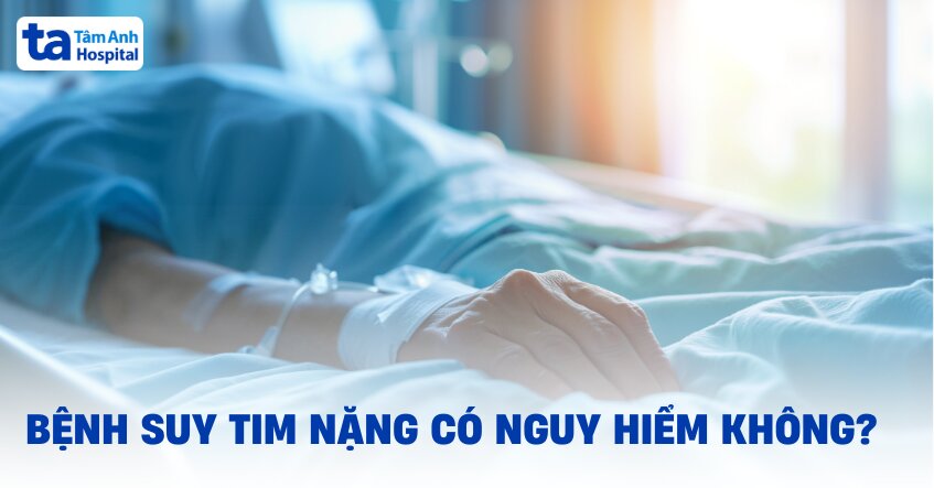 Bệnh suy tim nặng phải làm sao? Dấu hiệu và cách chẩn đoán