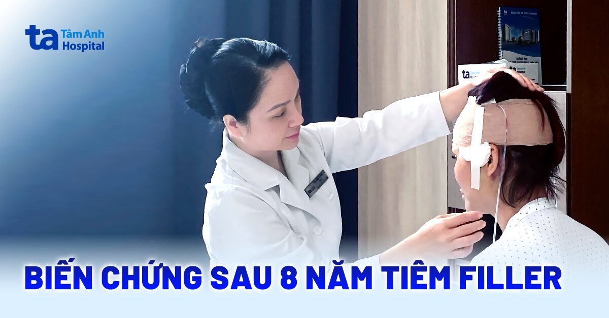 biến chứng sau 8 năm tiêm filler