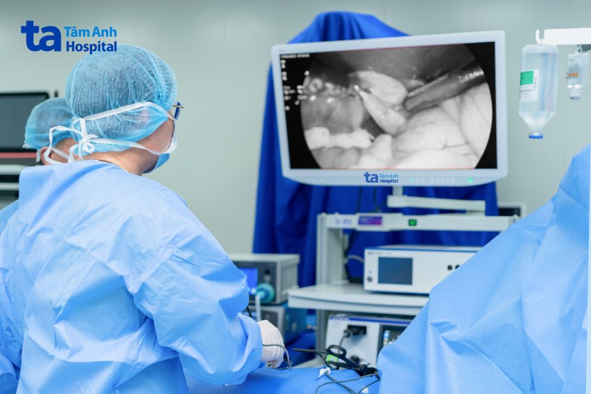 ca sỏi lớn gây tắc ống mật