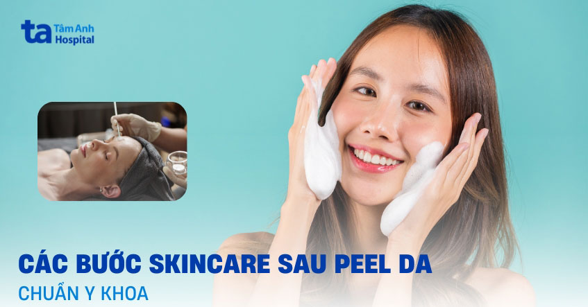 Các bước skincare sau khi peel da theo từng thời điểm trong ngày
