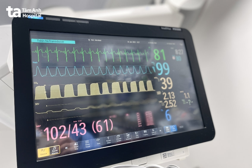 Monitor theo dõi của máy gây mê