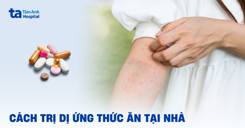 9 cách trị dị ứng thức ăn tại nhà đơn giản, hiệu quả và an toàn