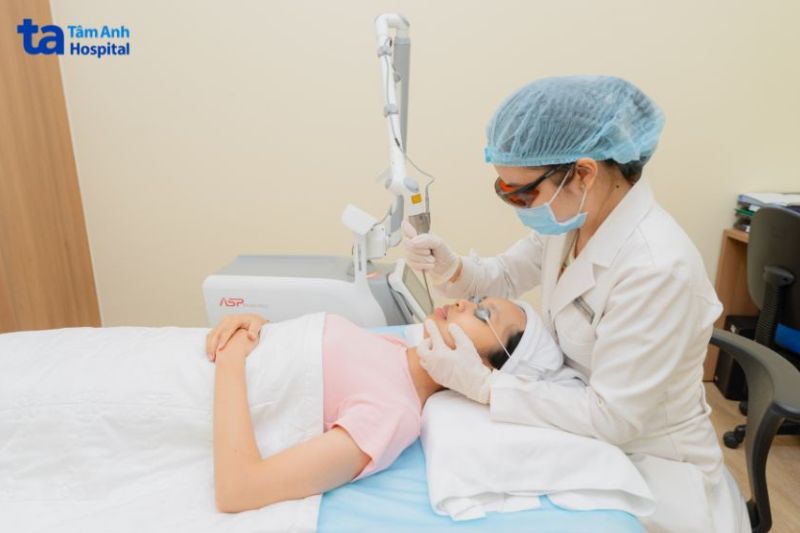 điều trị thâm môi tại tâm anh bằng Laser Pico