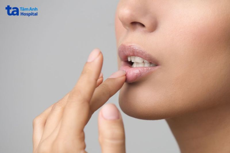 điều trị thâm môi phụ thuộc vào cách chăm sóc sau điều trị