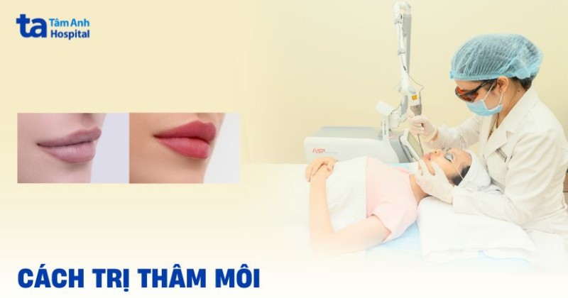 7 cách trị thâm môi nhanh hiệu quả giúp môi hồng hào