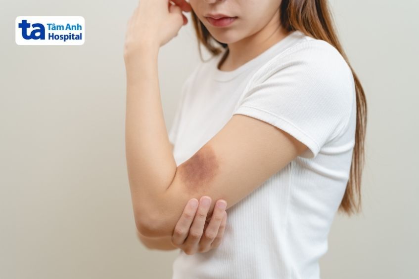 Người bệnh có thể áp dụng một số cách giúp da phục hồi nhanh hơn