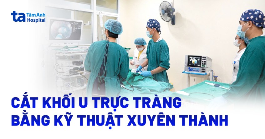 cắt khối u trực tràng bằng kỹ thuật xuyên thành