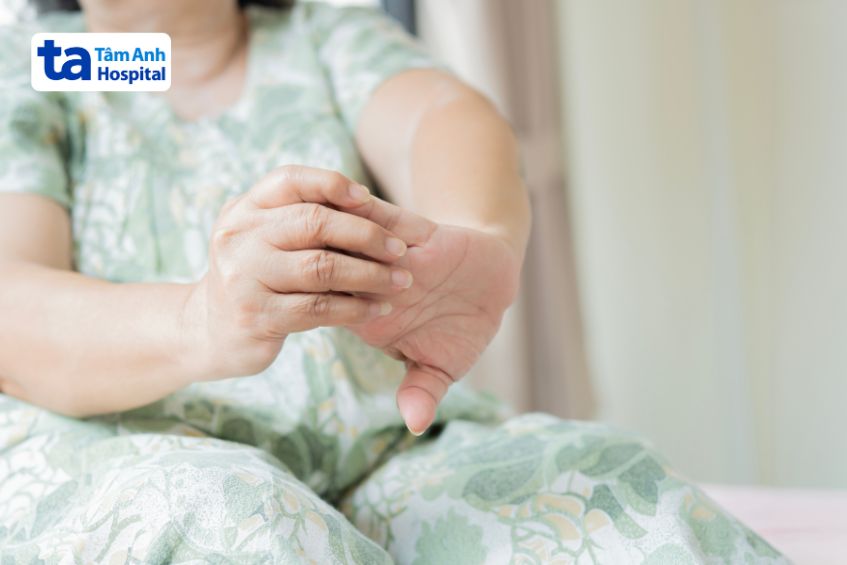 Chăm sóc người bệnh viêm khớp dạng thấp tại nhà