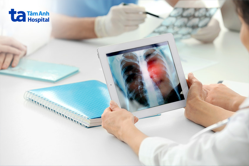 Các vị trí gãy xương do loãng xương thường gặp nhất