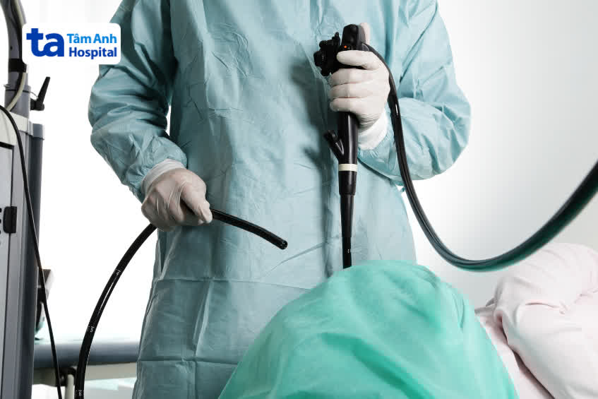 chẩn đoán giãn tĩnh mạch thực quản