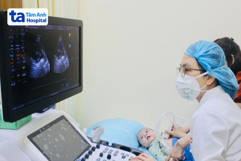 Chẩn đoán thông liên thất phần cơ ở trẻ sơ sinh bằng phương pháp siêu âm tim