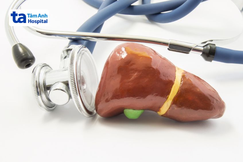 chẩn đoán viêm gan nhiễm mỡ