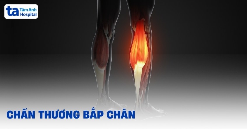 Chấn thương bắp chân: Triệu chứng, phòng ngừa và điều trị