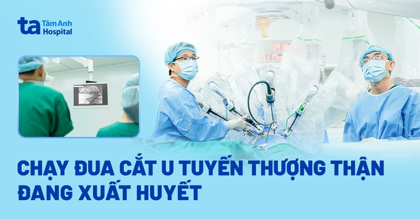 Chạy đua cắt u tuyến thượng thận đang xuất huyết