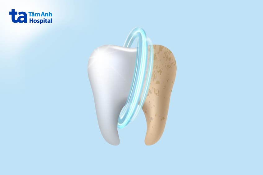 có nên làm trắng răng không