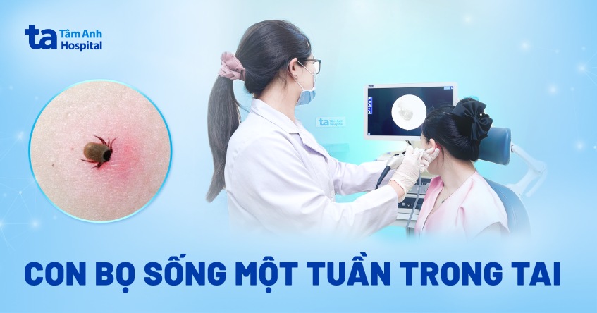 con bọ sống một tuần trong tai