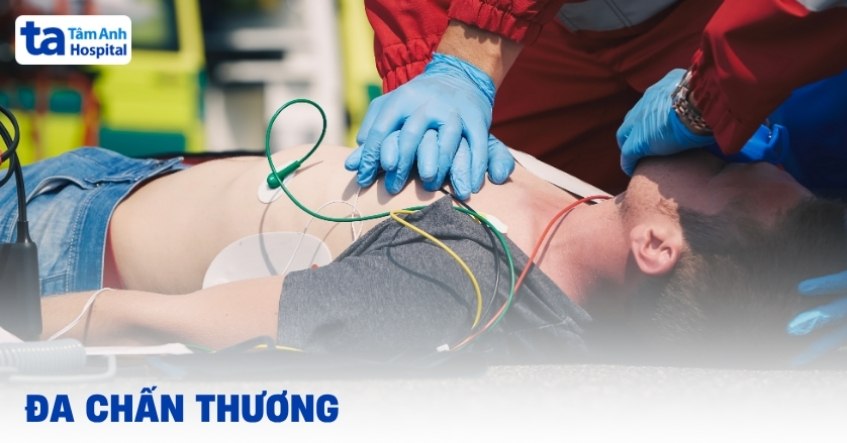 Đa chấn thương: Cách sơ cứu, điều trị và phục hồi đúng cách