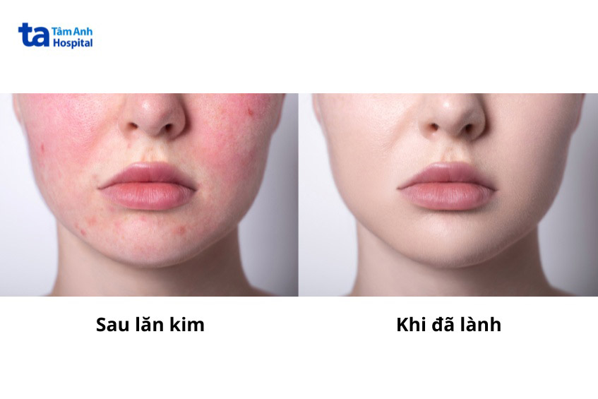 da sẽ phục hồi và săn chắc