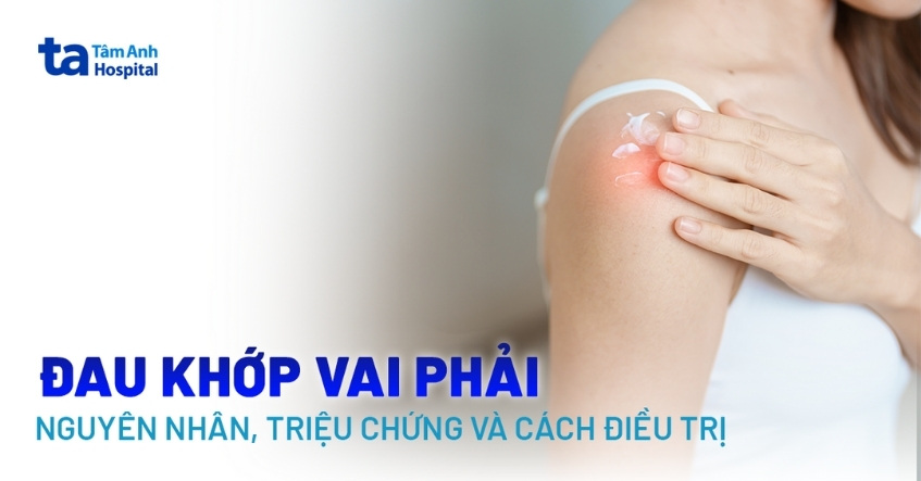 Đau khớp vai phải