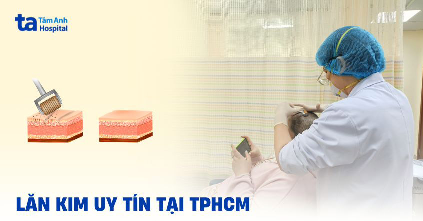 Gợi ý 2 địa chỉ lăn kim uy tín ở TPHCM đảm bảo an toàn, hiệu quả