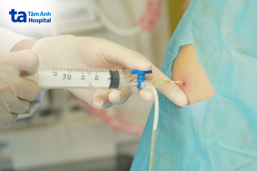 Điều trị cần bác sĩ chuyên khoa và cơ sở y tế có đầy đủ chuyên môn