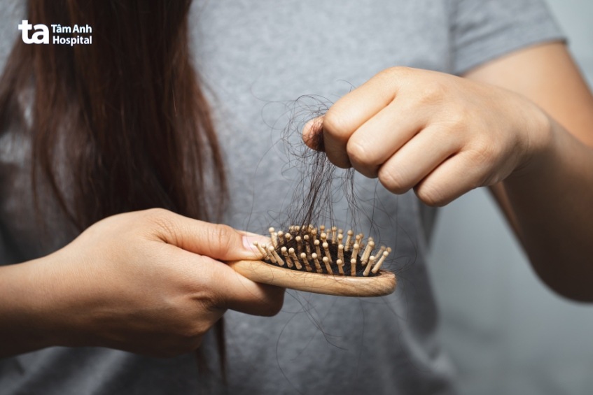 điều trị ung thư gây tác dụng phụ rụng tóc