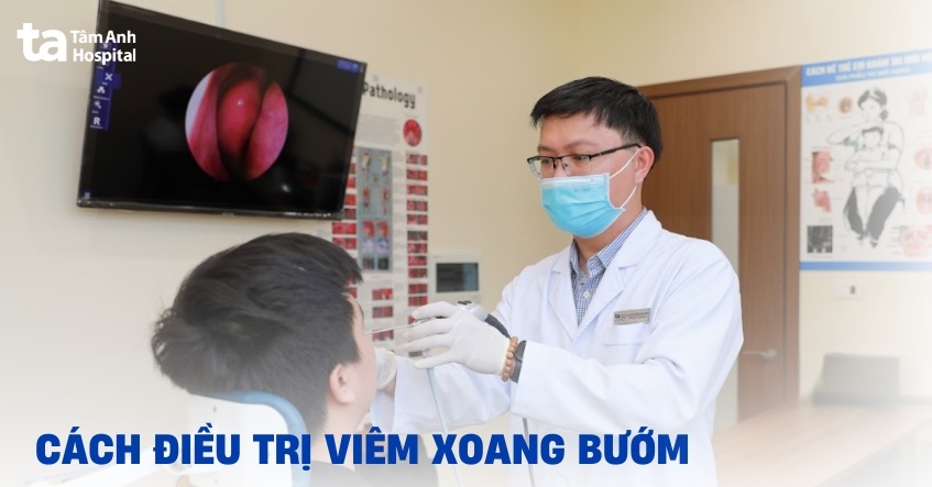 3 cách điều trị viêm xoang bướm hiệu quả và lưu ý khi chữa