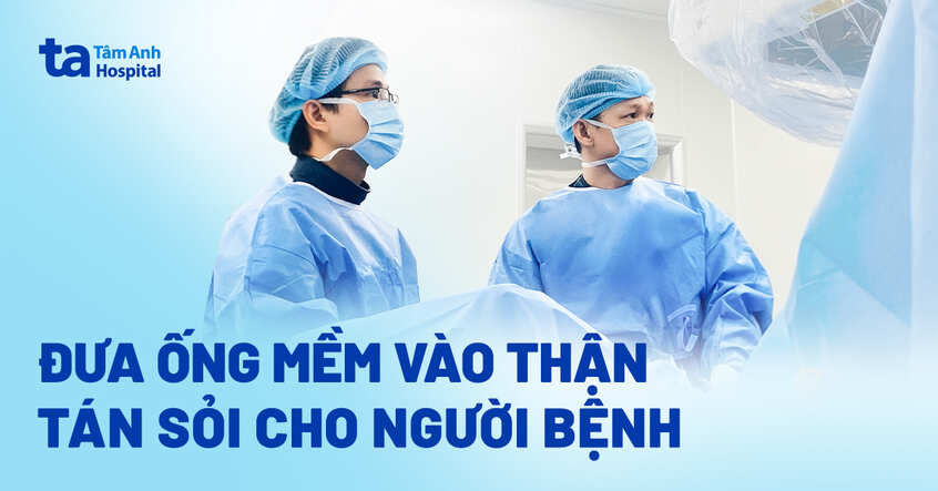 Đưa ống mềm vào thận lấy sỏi cho người bệnh