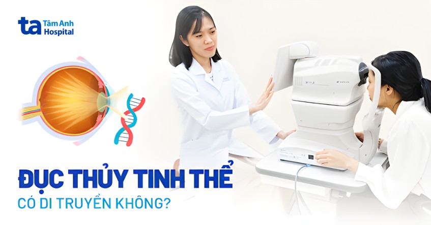 Bệnh đục thủy tinh thể có di truyền không? Cơ chế và cách điều trị