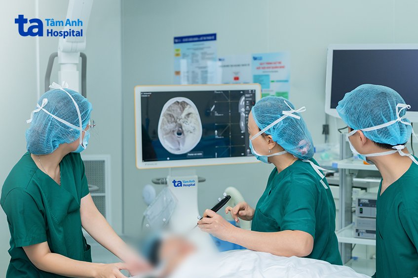 dùng AI chữa mũi xoang